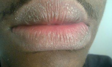 Menya uburyo  bwiza warinda iminwa  yawe  gusaduka