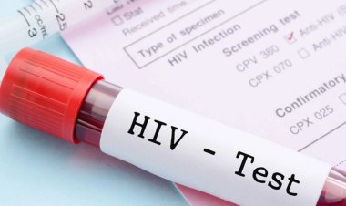 sobanukirwa itandukaniro  riri hagati y'umurwayi  wa SIDA n'ufite agakoko ka virusi itera SIDA